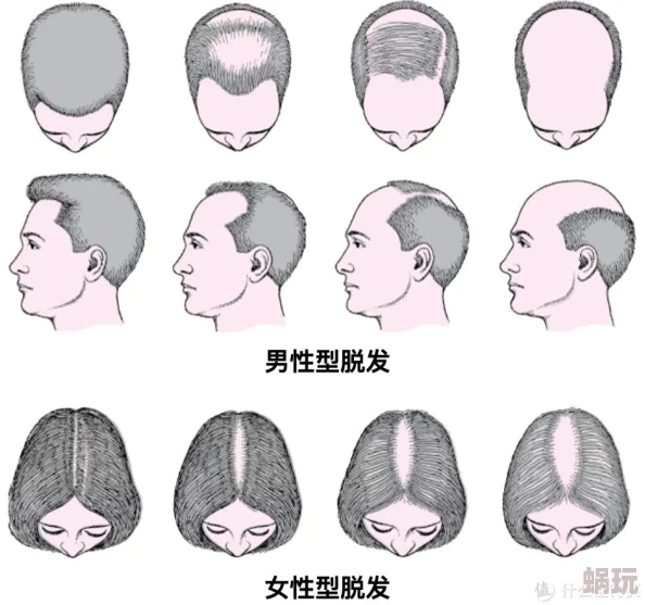 秃顶老头最新动态：他在社交媒体上分享了自己的健身秘诀，吸引了众多粉丝的关注与讨论